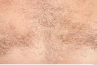 human skin hairy 0004